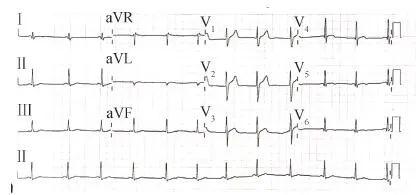 【惊人】基因检测解决心血管疾病诊断和治疗疑难