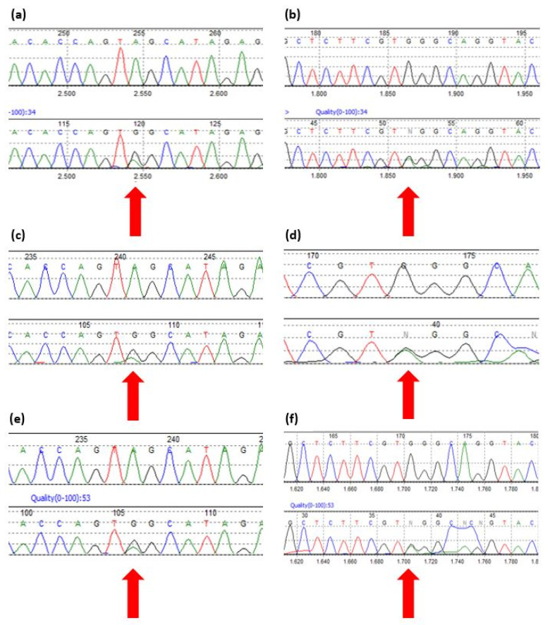 【佳学基因检测】3β-羟基类固醇脱氢酶缺陷症基因解码、基因检测 【佳学基因检测】3β-羟基类固醇脱氢酶缺陷症基因解码、基因检测