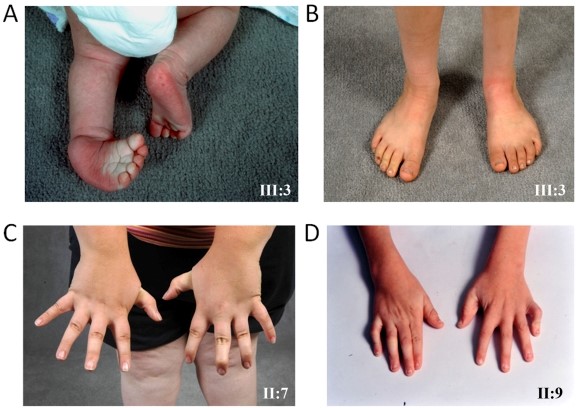 【佳学基因检测】这些关于CPB2的内容，是遗传测试准确性的必要条件