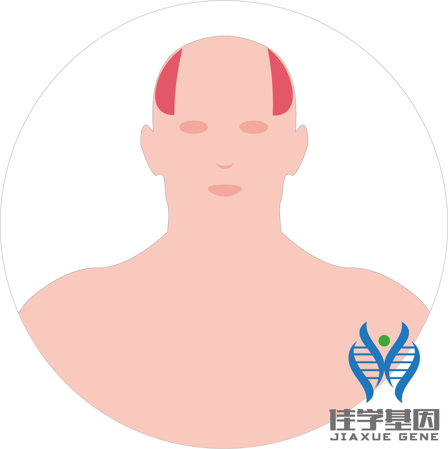 【佳学基因检测】男性脱发（Androgenetic alopecia）基因解码、基因检测