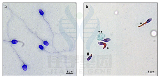 【佳学基因检测】畸形鞭毛精子症基因解码、基因检测