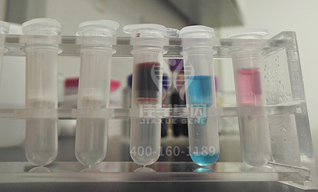 【佳学基因解码-基因检测】为什么到医院检查抽血需要空腹?喝水算不算空腹?看完你就明白了! 【佳学基因解码-基因检测】为什么到医院检查抽血需要空腹?喝水算不算空腹?看完你就明白了!