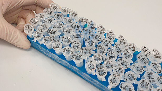 【佳学基因-基因检测】这个家庭15口人均是六指!基因解码找原因 【佳学基因-基因检测】这个家庭15口人均是六指!基因解码找原因